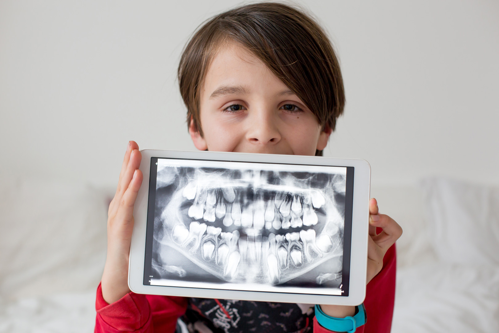 Dental Radiographs