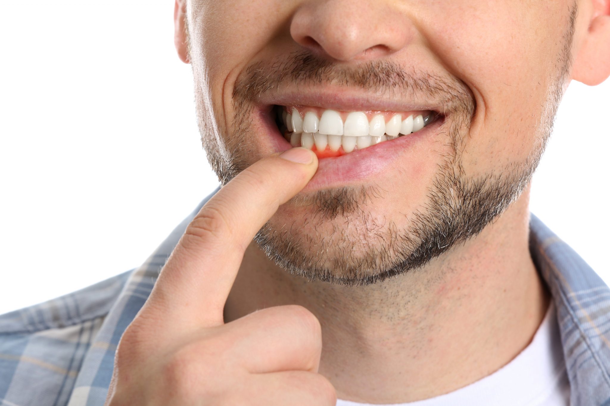 Do I need to fix crooked teeth?